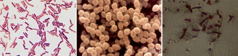 Escherichia coli, фекальний ентерокок і протой є основними причинними засобами хронічного бактеріального простатиту
